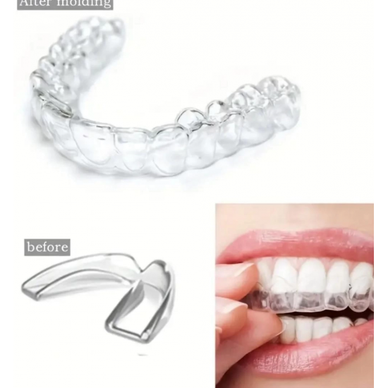 515 Bruksizm Gece Aparatı Plağı 515 Bruksizm Gece Aparatı Plağı