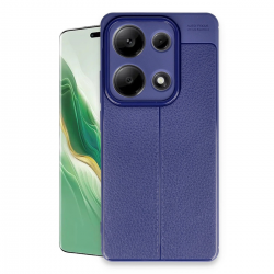 Newface Xiaomi Redmi Note 13 Pro 4g Kılıf Auto Focus Kapak - Lacivert